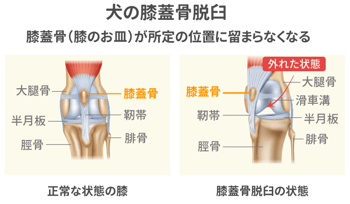 通常の膝とパテラ（膝蓋骨脱臼）の膝のイメージ図